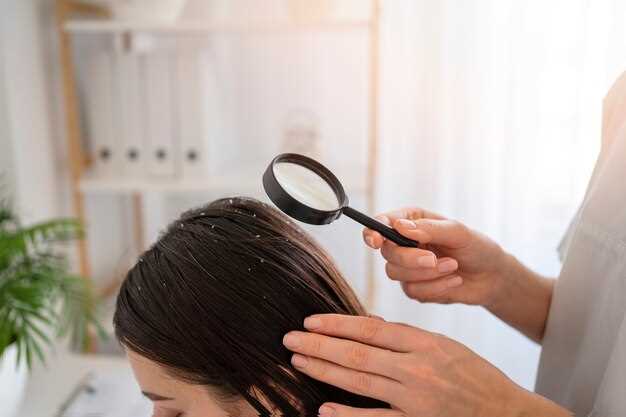 Levothyroxine for Hair Loss