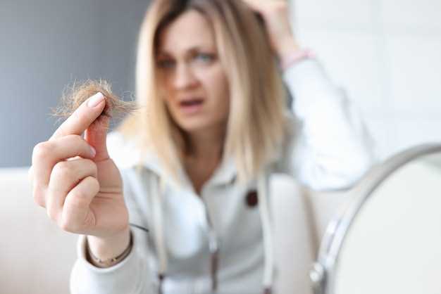 Alopecia levothyroxine