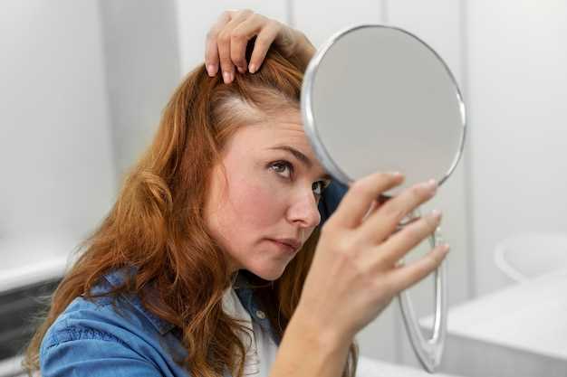 Hair loss levothyroxine vs synthroid