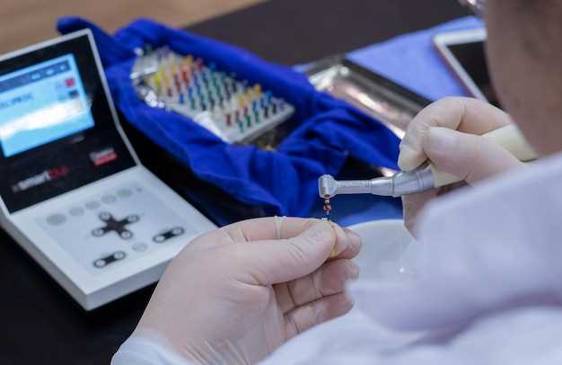 Levothyroxine monitoring