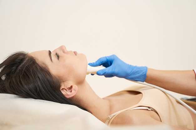 Levothyroxine treatment