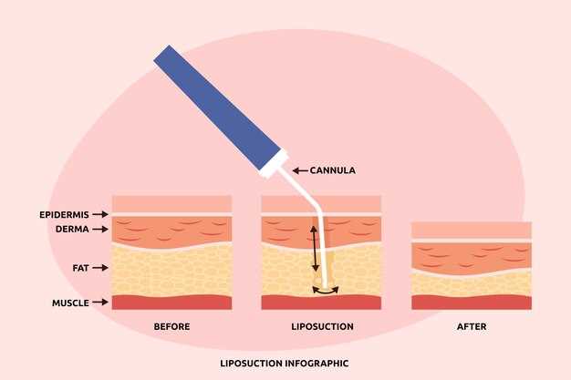 Transdermal levothyroxine